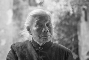 顔たるみを解消するための40代向けシワ改善医療ケアとは？