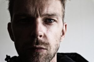 40代の顔のたるみを解消する美容医療の比較はどれが最適？