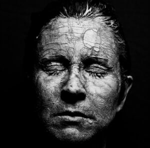 ハイフで顔のたるみを解消したい40代の方へ、口コミからわかる効果は？
